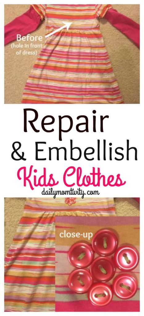 Are your kids coming home with holes in their pants constantly? Don't toss them, fix them up with simple iron on patches! All about embellishing your kids clothes for cheap! https://dailymomtivity.com